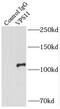 VPS11 Core Subunit Of CORVET And HOPS Complexes antibody, FNab09426, FineTest, Immunoprecipitation image 