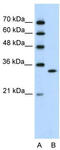 Ribonuclease H2 Subunit A antibody, TA345962, Origene, Western Blot image 