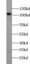 Toll Like Receptor 2 antibody, FNab10498, FineTest, Western Blot image 