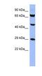 Small nuclear ribonucleoprotein-associated protein B antibody, NBP1-57215, Novus Biologicals, Western Blot image 