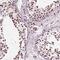 General Transcription Factor IIF Subunit 1 antibody, NBP2-68907, Novus Biologicals, Immunohistochemistry frozen image 