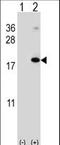 Ring Finger Protein 5 antibody, LS-C162666, Lifespan Biosciences, Western Blot image 