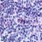 Psychosine receptor antibody, LS-A1627, Lifespan Biosciences, Immunohistochemistry paraffin image 
