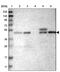 Solute Carrier Family 43 Member 1 antibody, PA5-53851, Invitrogen Antibodies, Western Blot image 
