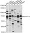 Polypeptide N-Acetylgalactosaminyltransferase 10 antibody, LS-C749890, Lifespan Biosciences, Western Blot image 