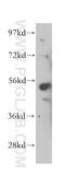 Signal Recognition Particle 54 antibody, 17976-1-AP, Proteintech Group, Western Blot image 