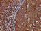 Immunoglobulin Heavy Constant Mu antibody, LS-C680644, Lifespan Biosciences, Immunohistochemistry paraffin image 