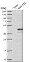 Hydroxysteroid 17-Beta Dehydrogenase 2 antibody, PA5-54523, Invitrogen Antibodies, Western Blot image 