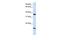 Claudin 16 antibody, GTX47761, GeneTex, Western Blot image 