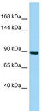 Histone H2A deubiquitinase MYSM1 antibody, TA334332, Origene, Western Blot image 