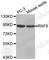 Ring Finger Protein 6 antibody, A3326, ABclonal Technology, Western Blot image 