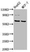 Folylpolyglutamate Synthase antibody, LS-C680494, Lifespan Biosciences, Western Blot image 