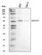 UDP Glucuronosyltransferase Family 1 Member A10 antibody, A04459, Boster Biological Technology, Western Blot image 