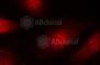 RB Transcriptional Corepressor 1 antibody, AP0444, ABclonal Technology, Immunofluorescence image 