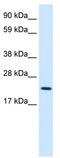 MYCL Proto-Oncogene, BHLH Transcription Factor antibody, TA339110, Origene, Western Blot image 
