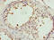 Protein phosphatase 1 regulatory subunit 7 antibody, orb356183, Biorbyt, Immunohistochemistry paraffin image 