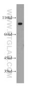 E3 ubiquitin-protein ligase UHRF1 antibody, 21402-1-AP, Proteintech Group, Western Blot image 