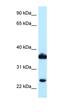 Prostaglandin F synthase antibody, orb331134, Biorbyt, Western Blot image 