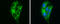 4-Aminobutyrate Aminotransferase antibody, GTX100479, GeneTex, Immunocytochemistry image 