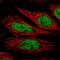 Nucleoporin 188 antibody, HPA061750, Atlas Antibodies, Immunofluorescence image 
