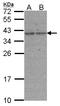 DNA repair protein XRCC3 antibody, LS-C109286, Lifespan Biosciences, Western Blot image 