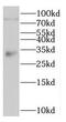 LIM Domain Binding 3 antibody, FNab04734, FineTest, Western Blot image 