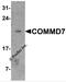 COMM Domain Containing 7 antibody, 7541, ProSci, Western Blot image 