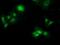 Phenazine Biosynthesis Like Protein Domain Containing antibody, MA5-25311, Invitrogen Antibodies, Immunocytochemistry image 