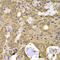 N(Alpha)-Acetyltransferase 20, NatB Catalytic Subunit antibody, 22-702, ProSci, Immunohistochemistry paraffin image 