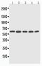 Cytochrome P450 Family 2 Subfamily U Member 1 antibody, PA2022, Boster Biological Technology, Western Blot image 