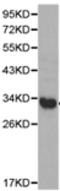 Pyrophosphatase (Inorganic) 1 antibody, TA322229, Origene, Western Blot image 