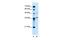 Armadillo Repeat Containing X-Linked 6 antibody, GTX46680, GeneTex, Western Blot image 