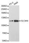 SLC4A4 antibody, PA5-76715, Invitrogen Antibodies, Western Blot image 