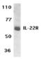 Interleukin 22 Receptor Subunit Alpha 1 antibody, TA306082, Origene, Western Blot image 