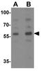 Zinc finger protein PLAGL2 antibody, GTX32095, GeneTex, Western Blot image 