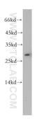 Tubulin Polymerization Promoting Protein antibody, 18742-1-AP, Proteintech Group, Western Blot image 