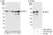 KOC antibody, A303-426A, Bethyl Labs, Immunoprecipitation image 
