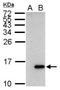 Galectin 7B antibody, NBP2-16584, Novus Biologicals, Western Blot image 