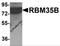 RBM35B antibody, 6187, ProSci Inc, Western Blot image 