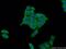 S100 Calcium Binding Protein P antibody, 11803-1-AP, Proteintech Group, Immunofluorescence image 