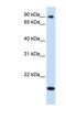 TSR1 Ribosome Maturation Factor antibody, NBP1-55349, Novus Biologicals, Western Blot image 
