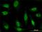 Zinc Finger Protein 181 antibody, H00339318-M01, Novus Biologicals, Immunofluorescence image 