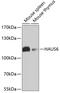 HAUS Augmin Like Complex Subunit 6 antibody, GTX65582, GeneTex, Western Blot image 