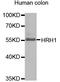 Histamine Receptor H1 antibody, LS-C331459, Lifespan Biosciences, Western Blot image 