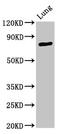 Ataxin 7 antibody, LS-C671705, Lifespan Biosciences, Western Blot image 
