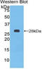 PTC1 antibody, LS-C295775, Lifespan Biosciences, Western Blot image 