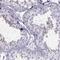 Family With Sequence Similarity 24 Member B antibody, PA5-62623, Invitrogen Antibodies, Immunohistochemistry paraffin image 