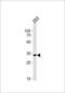E3 ubiquitin-protein ligase CHIP antibody, MBS9202585, MyBioSource, Western Blot image 