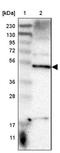 Sorting Nexin Family Member 30 antibody, NBP1-90841, Novus Biologicals, Immunohistochemistry frozen image 