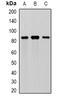 Meprin A Subunit Alpha antibody, abx225290, Abbexa, Western Blot image 